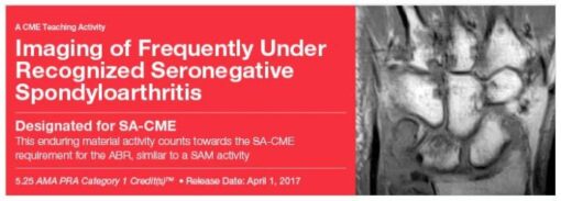 Imaging of Frequently Under Recognized Seronegative Spondyloarthritis - A Video CME Teaching Activity