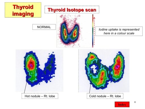 Thyroid Imaging