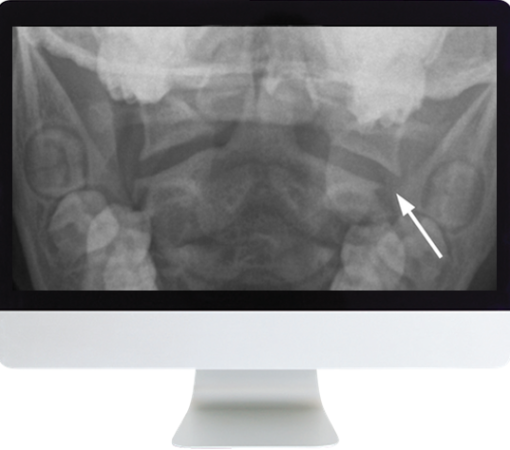 Neuroradiology Review for the Practicing Radiologist