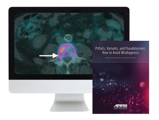 Pitfalls, Variants, and Pseudolesions: How to Avoid Misdiagnosis