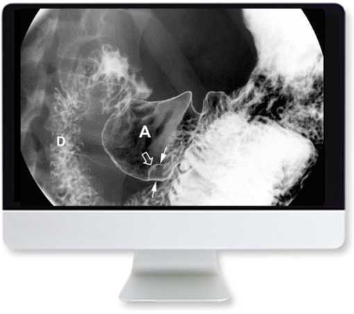 Clinical Case-Based Review of Abdominal Imaging