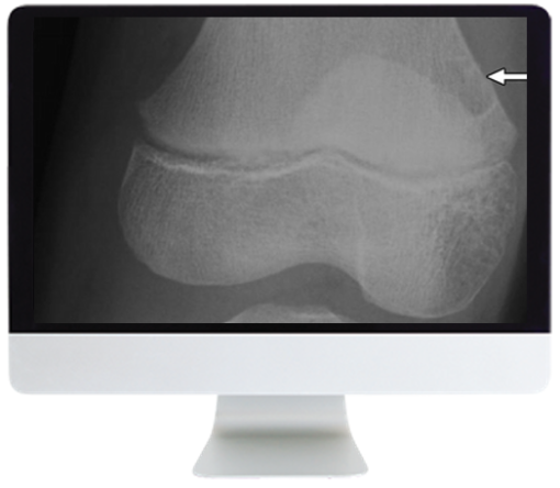 Clinical Case-Based Review of Musculoskeletal Imaging