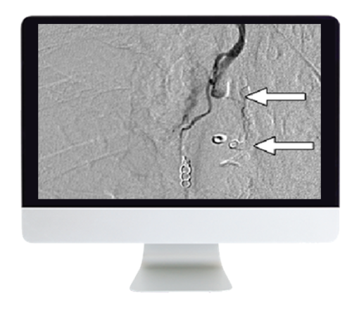 Clinical Case-Based Review of Vascular and Interventional Imaging