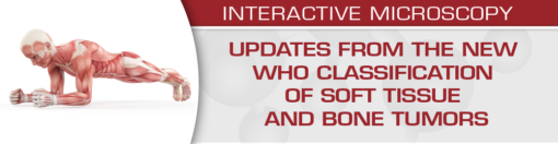 Updates from the New WHO Classification of Soft Tissue and Bone Tumors