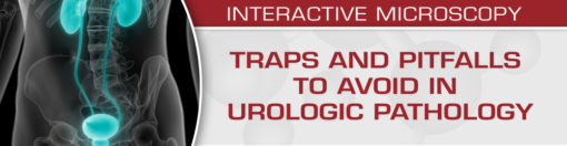 Traps And Pitfalls To Avoid In Urologic Pathology