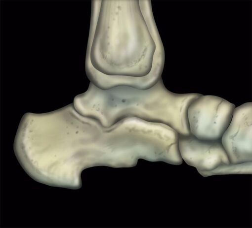 MRI Mastery Series: Ankle 2017 