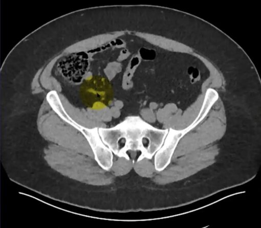 MRIOnline Imaging Mastery Series: Appendix 2021