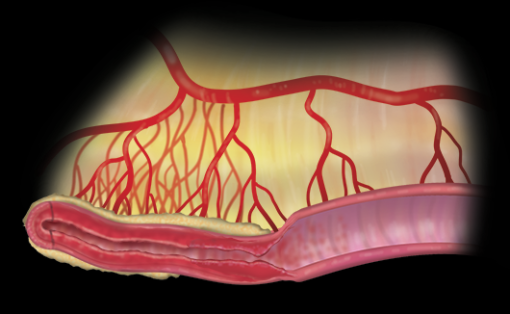 Imaging Mastery Series: Crohn's Disease 2021