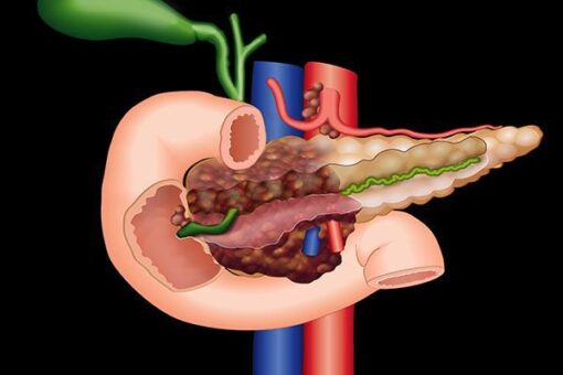 Imaging Mastery Series: Pancreas Imaging 2021