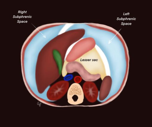 Imaging Mastery Series: Peritoneum and Mesentery 2021