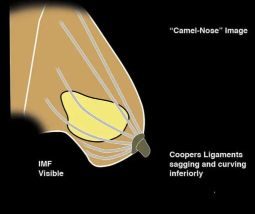 Imaging Mastery Series: Regulatory/Standards of Care in Breast Imaging 2021