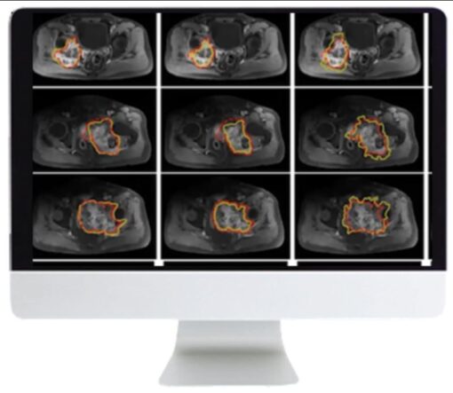 Crossroads of Computational Science and Musculoskeletal Imaging: Where Machine Magic Can Aid Radiologists 2021