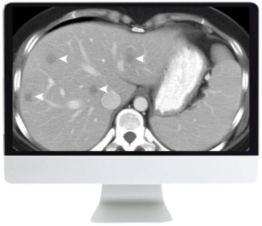 SAR Disease-Focused Panels: Cancer Imaging and Reporting Guidelines 2021