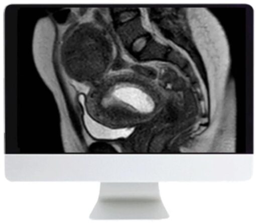 ARRS Abdominal MRI: Practical Applications and Advanced Imaging Techniques 2021