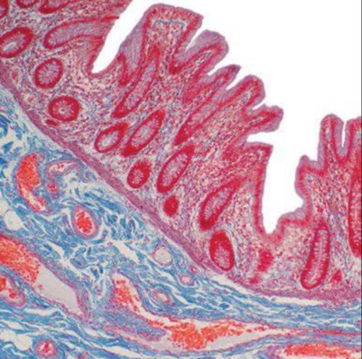 Current Topics in Gastrointestinal and Liver Pathology 2022