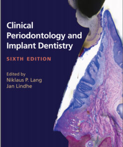 Ebook Clinical Periodontology and Implant Dentistry, 2 Volume Set 6th Edition