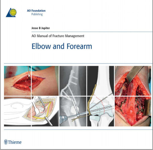 AO Manual of Fracture Management: Elbow & Forearm: Elbow & Forearm