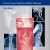 Early Onset Scoliosis: A Comprehensive Guide from the Oxford Meetings