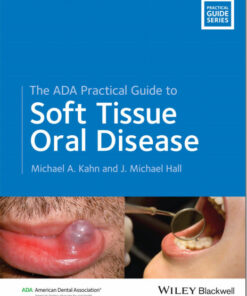 Ebook  The ADA Practical Guide to Soft Tissue Oral Disease