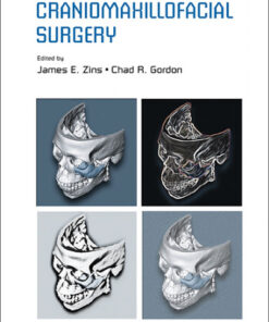 Ebook  Handbook of Craniomaxillofacial Surgery 1st Edition