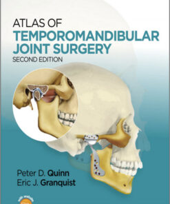 Ebook  Atlas of Temporomandibular Joint Surgery 2nd Edition