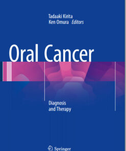 Ebook  Oral Cancer: Diagnosis and Therapy 2015th Edition