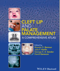 Ebook  Cleft Lip and Palate Management: A Comprehensive Atlas 1st Edition