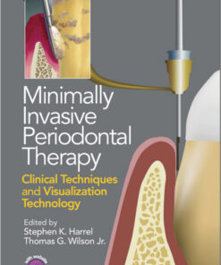 Ebook  Minimally Invasive Periodontal Therapy: Clinical Techniques and Visualization Technology 1st Edition