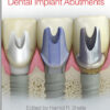 Ebook Clinical and Laboratory Manual of Dental Implant Abutments 1st Edition