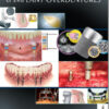 Ebook Clinical and Laboratory Manual of Implant Overdentures 1st Edition