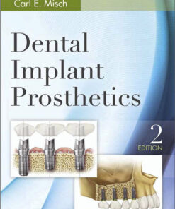 Ebook Dental Implant Prosthetics, 2e 2nd Edition