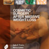 Cosmetic Surgery After Massive Weight Loss 1st Edition