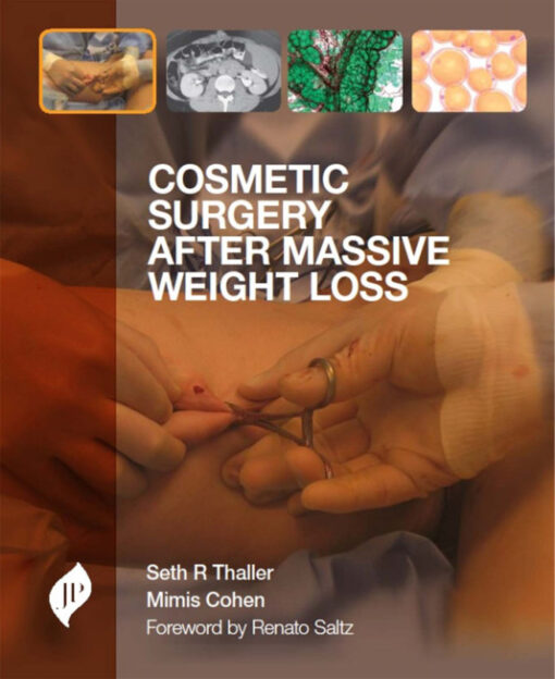 Cosmetic Surgery After Massive Weight Loss 1st Edition