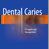 Ebook Dental Caries: Principles and Management 1st ed. 2016 Edition