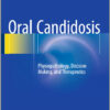 Oral Candidosis: Physiopathology, Decision Making, and Therapeutics 2015 Edition