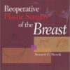 Reoperative Plastic Surgery of the Breast 1st Edition