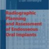 Radiographic Planning and Assessment of Endosseous Oral Implants