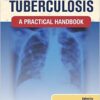 Clinical Tuberculosis: A Practical Handbook