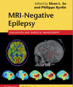 MRI-Negative Epilepsy: Evaluation and Surgical Management 1st Edition