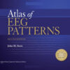 Atlas of EEG Patterns Second Edition