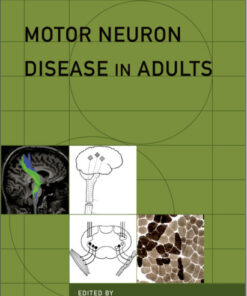 Motor Neuron Disease in Adults (Contemporary Neurology Series) 1st Edition