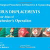 Uterus Displacements: A Colour Atlas of Manchester's Operation 1st Edition