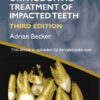 Orthodontic Treatment of Impacted Teeth 3rd Edition