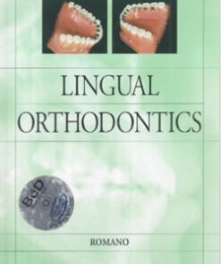 Lingual Orthodontics