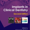 Implants in Clinical Dentistry, Second Edition