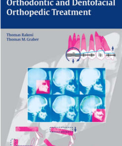 Orthodontic and Dentofacial Orthopedic Treatment 1st Edition Edition