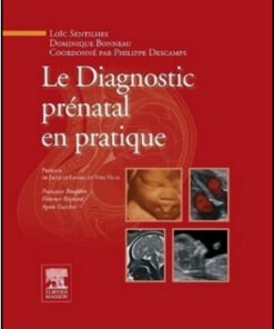 Le Diagnostic prénatal en pratique (French Edition)