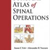 Surgical Atlas of Spinal Operations 1st Edition