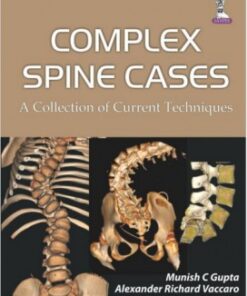 Complex Spine Cases: A Collection of Current Techniques 1st Edition