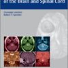 Cavernous Malformations of the Brain and Spinal Cord 1st edition